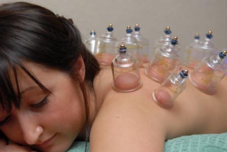 cupping_therapy cupping_therapy